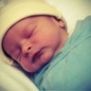 Jaundice in a Newborn